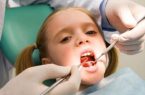 اوضاع نامناسب دندان کودکان مازندرانی