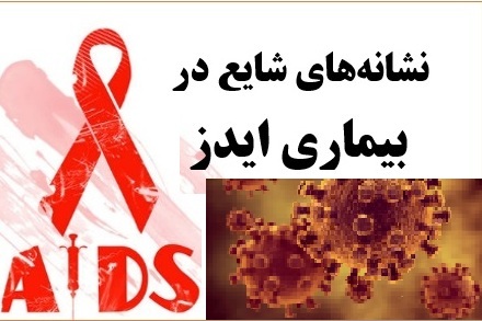علائم ابتلا به ایدز ( HIV ) را بشناسید