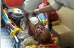 حمله پلنگ درنده، چوپان بخت برگشته مازندرانی را راهی بیمارستان کرد + تصاویر
